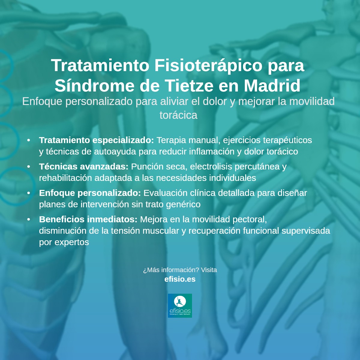 Imagen resumen sobre Síndrome de Tietze (afectando los cartílagos pectorales)