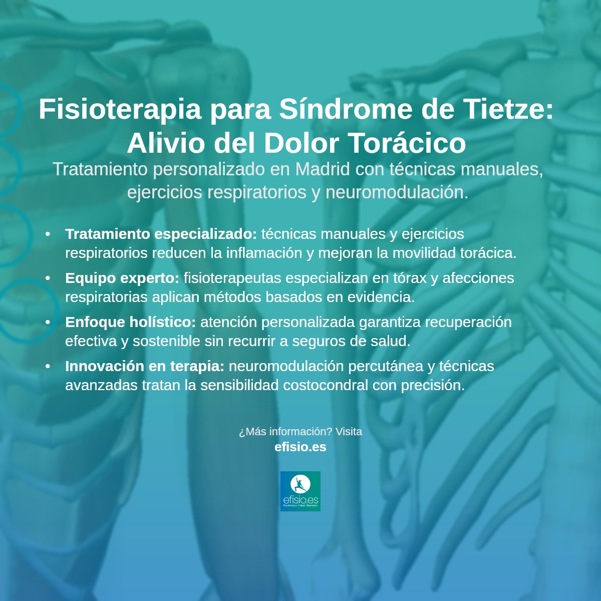 Imagen resumen sobre Síndrome de Tietze (Costocondritis)