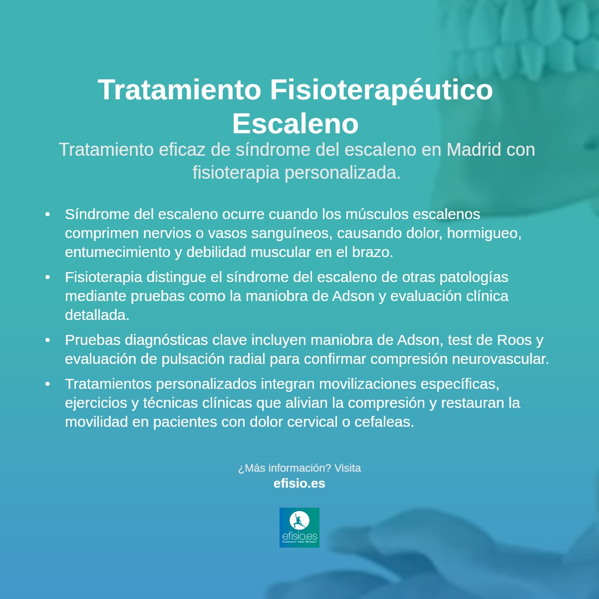 Imagen resumen sobre Síndrome del Escaleno