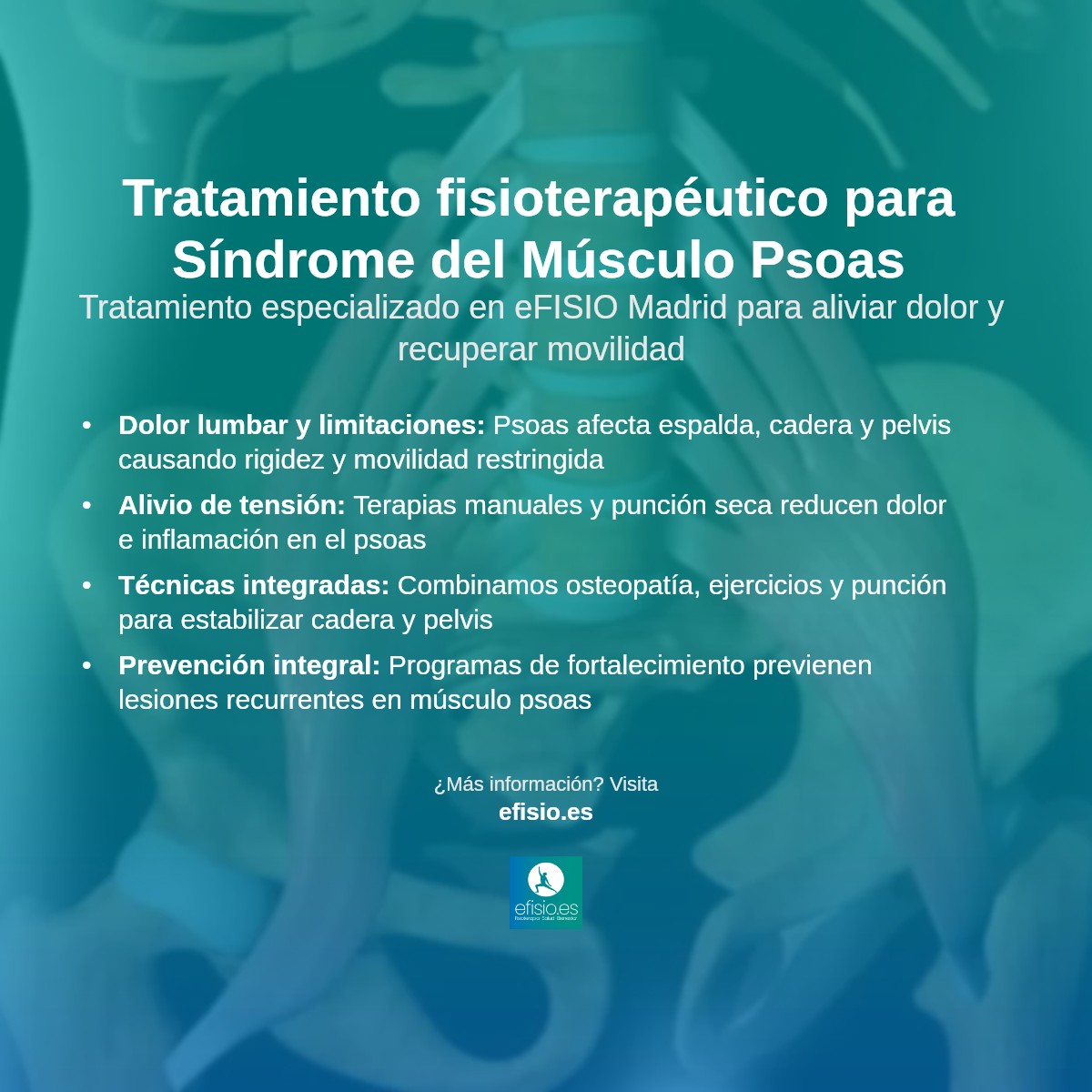 Imagen resumen sobre Síndrome del Músculo Psoas