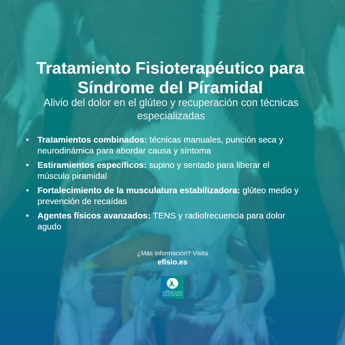 ¿Ciática o Síndrome del Piramidal?