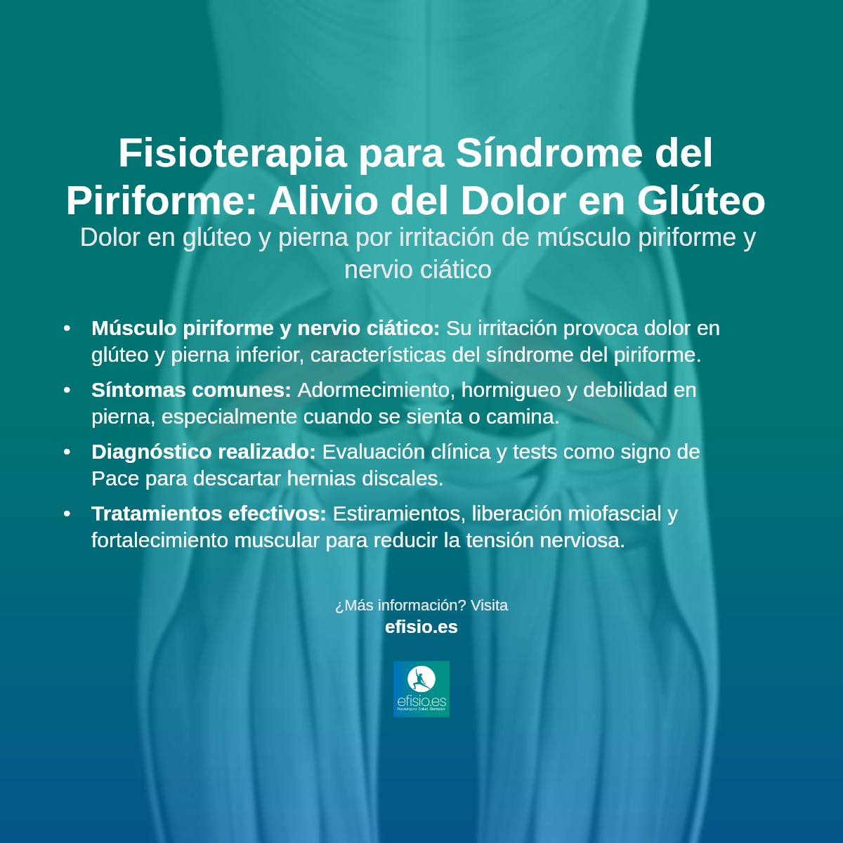 Imagen resumen sobre Síndrome del Piriforme