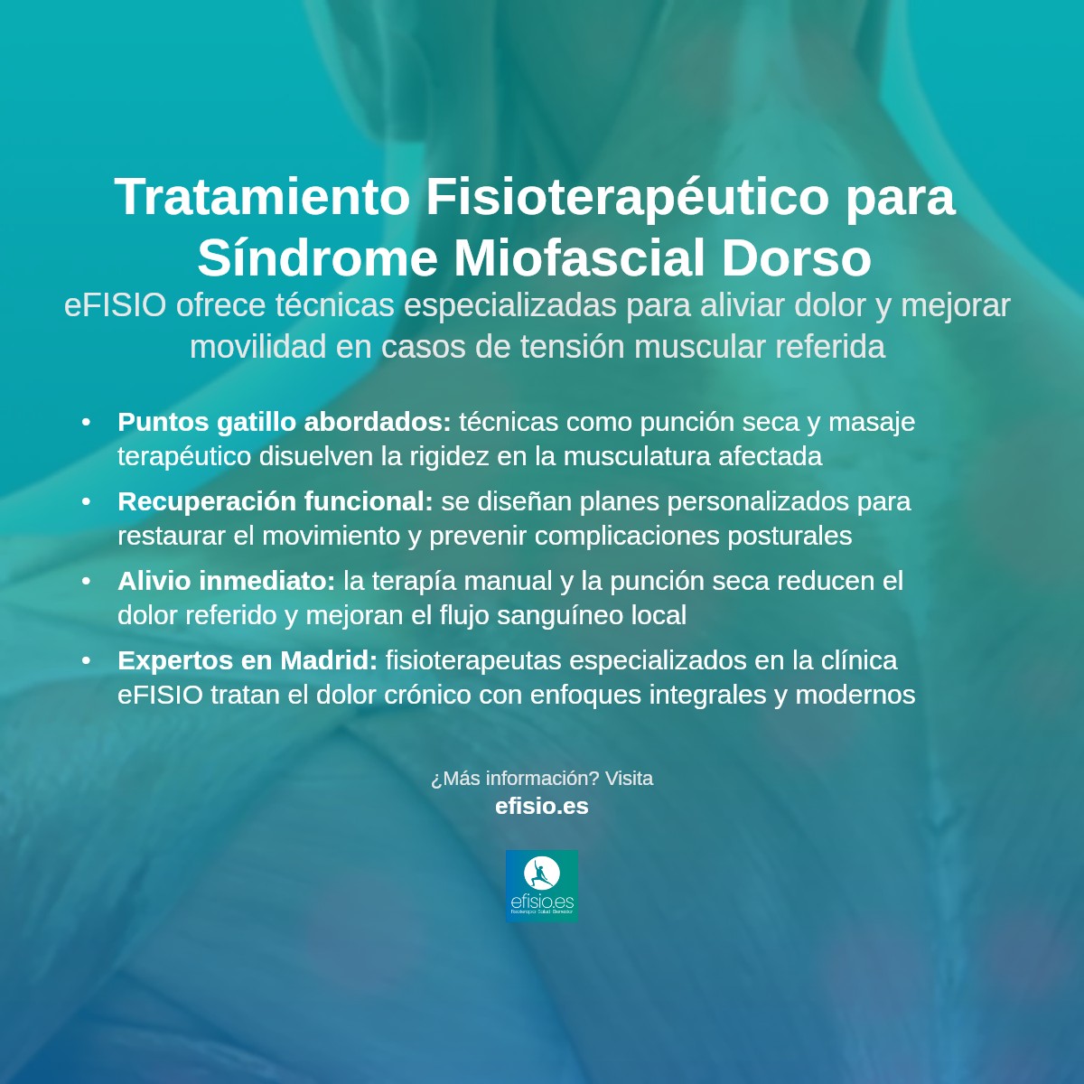 Imagen resumen sobre Síndrome Miofascial en la Región Dorsal