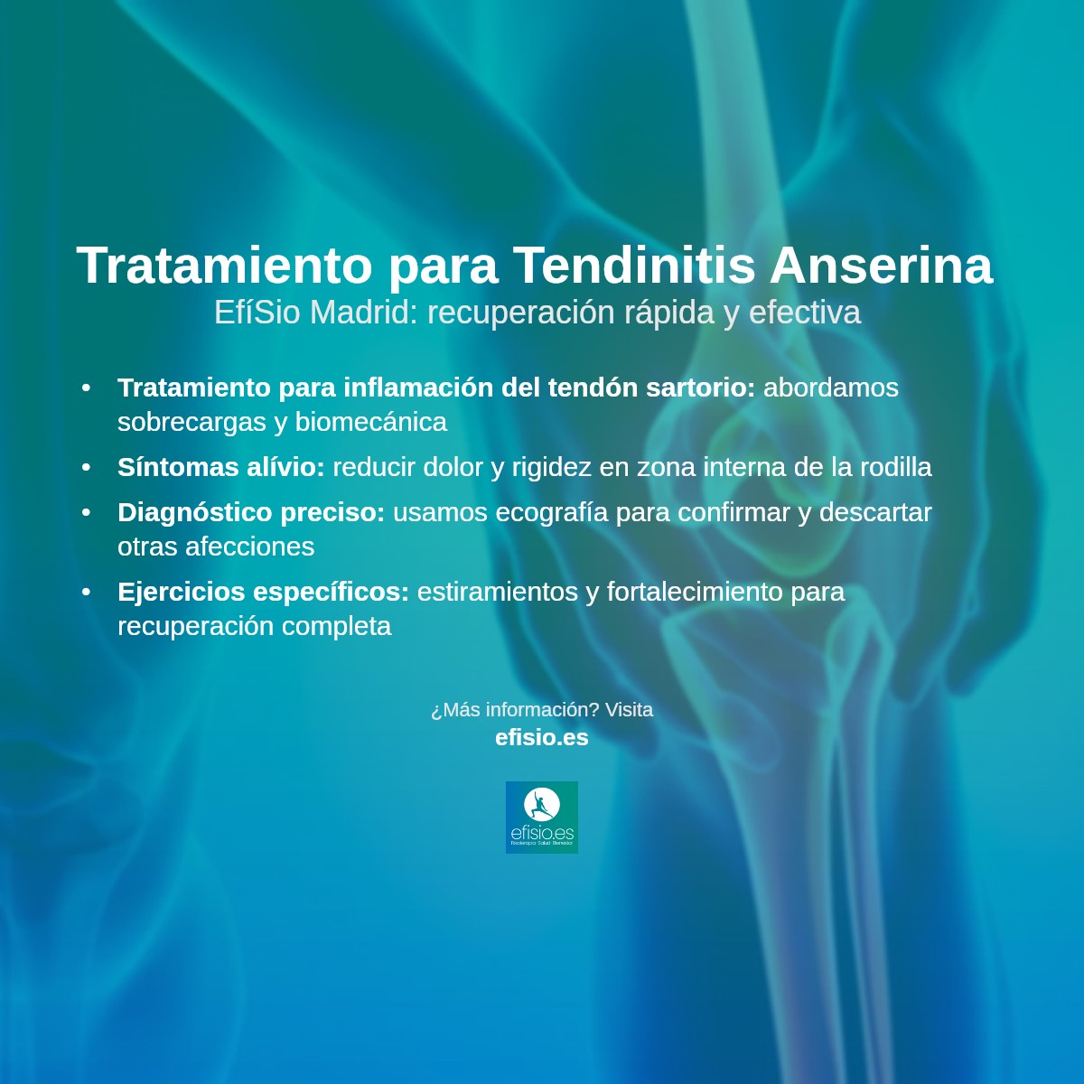 Imagen resumen sobre Tendinitis Anserina (Rodilla)