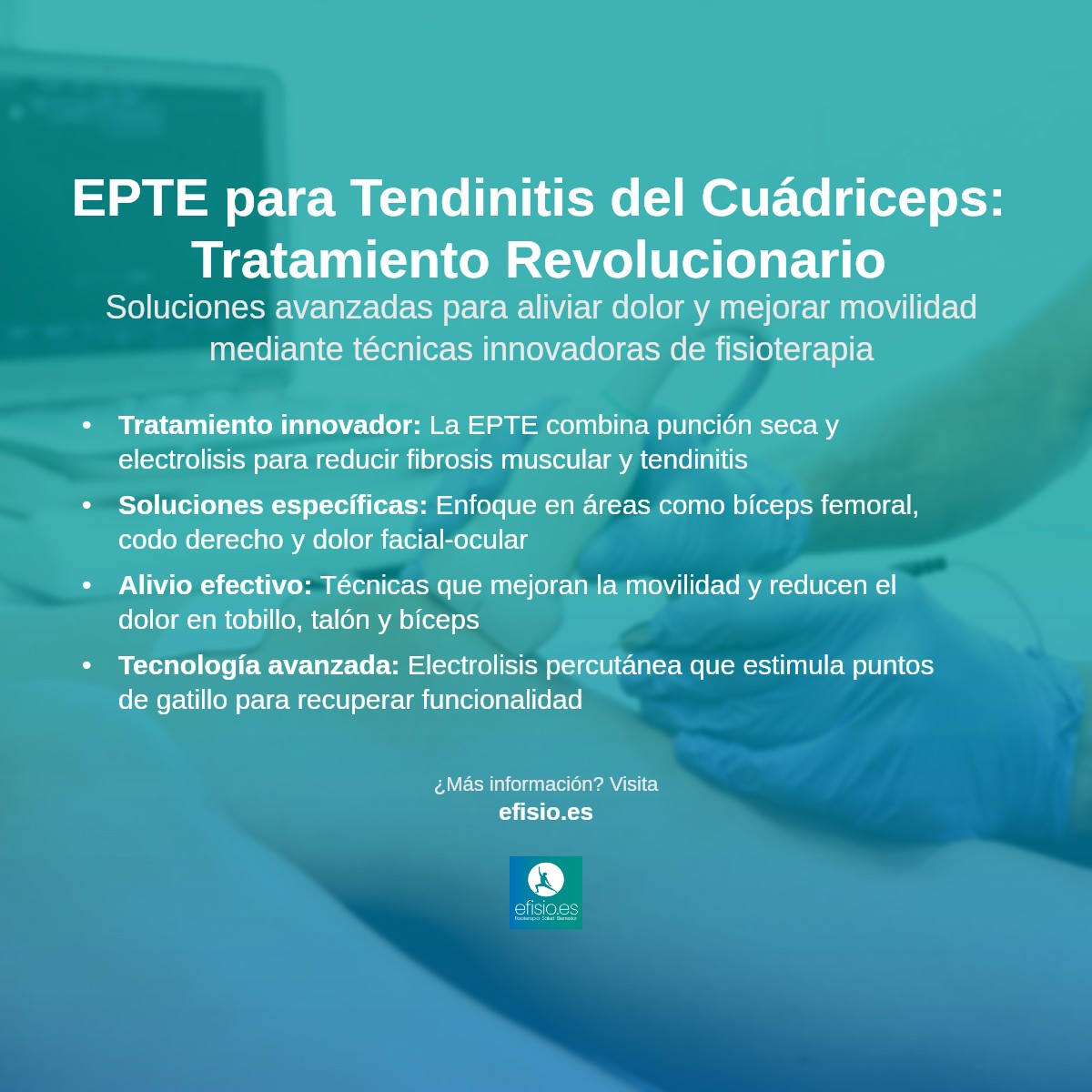Imagen resumen sobre Tendinitis del cuádriceps: Tratamiento con punción seca y electrolisis percutánea EPTE