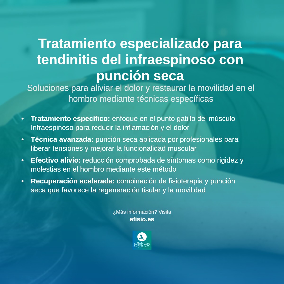 Imagen resumen sobre Tendinitis del músculo Infraespinoso: Tratamiento punto gatillo con Punción Seca