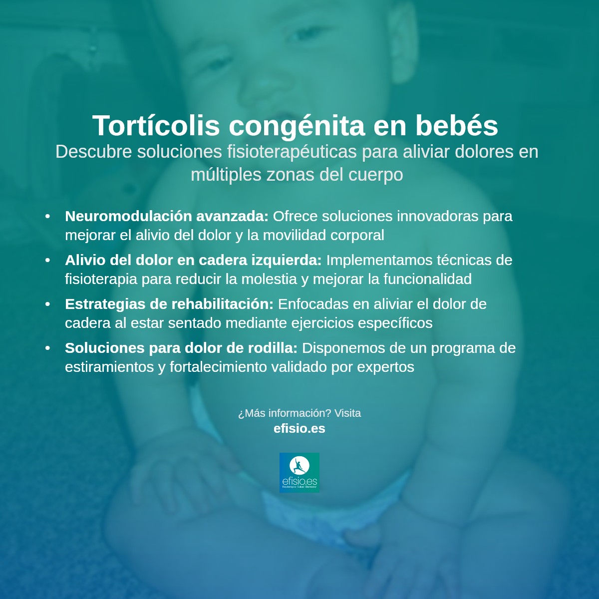 Imagen resumen sobre Tortícolis congénita en el bebé
