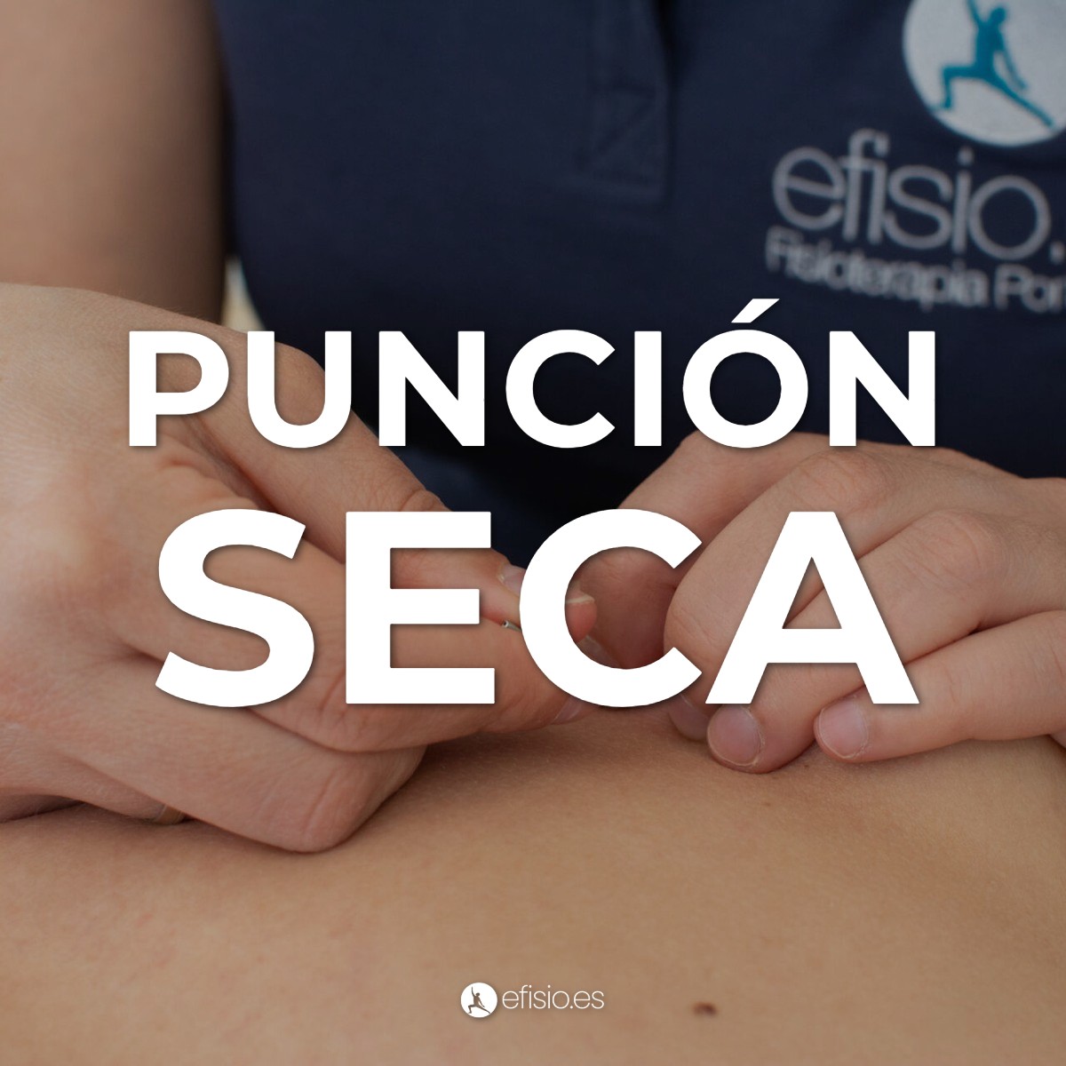 Punción Seca
