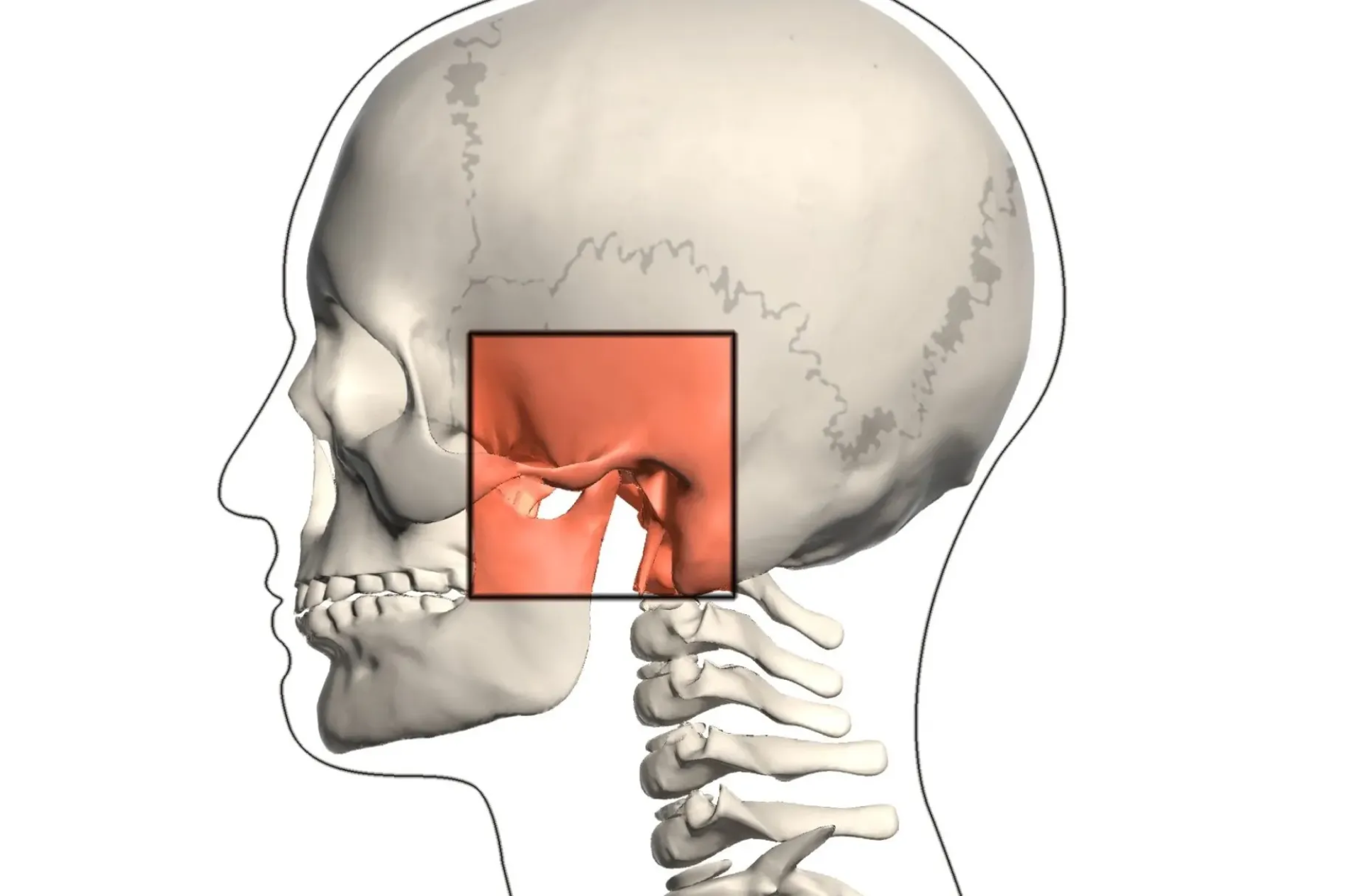 Capsulitis en la Articulación Temporomandibular (ATM)