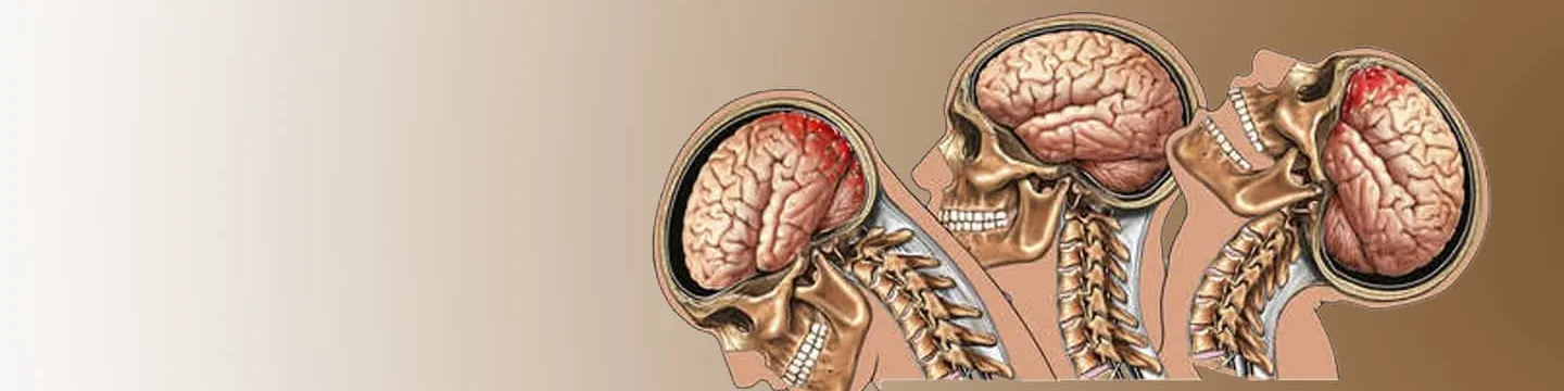Conmociones y Traumatismos Craneoencefálicos