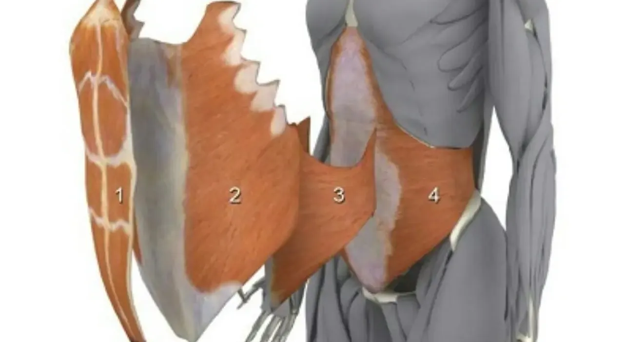 Diástasis de los rectos abdominales