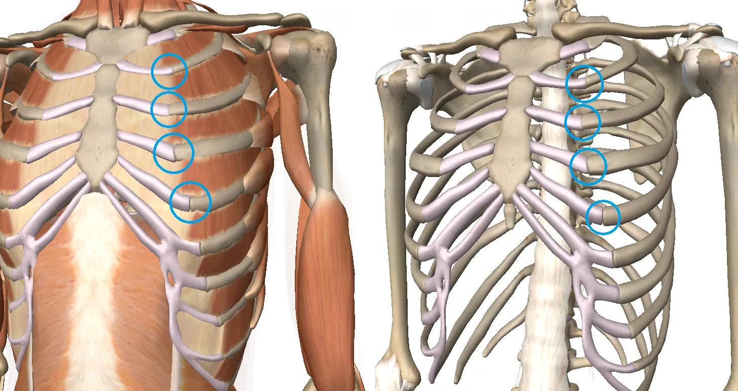 Disfunción de la Articulación Costoesternal