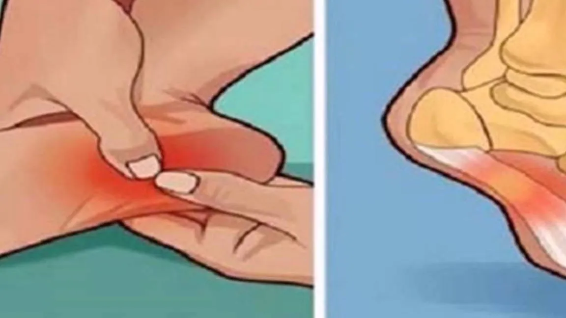 Dolor en la Base del Talón