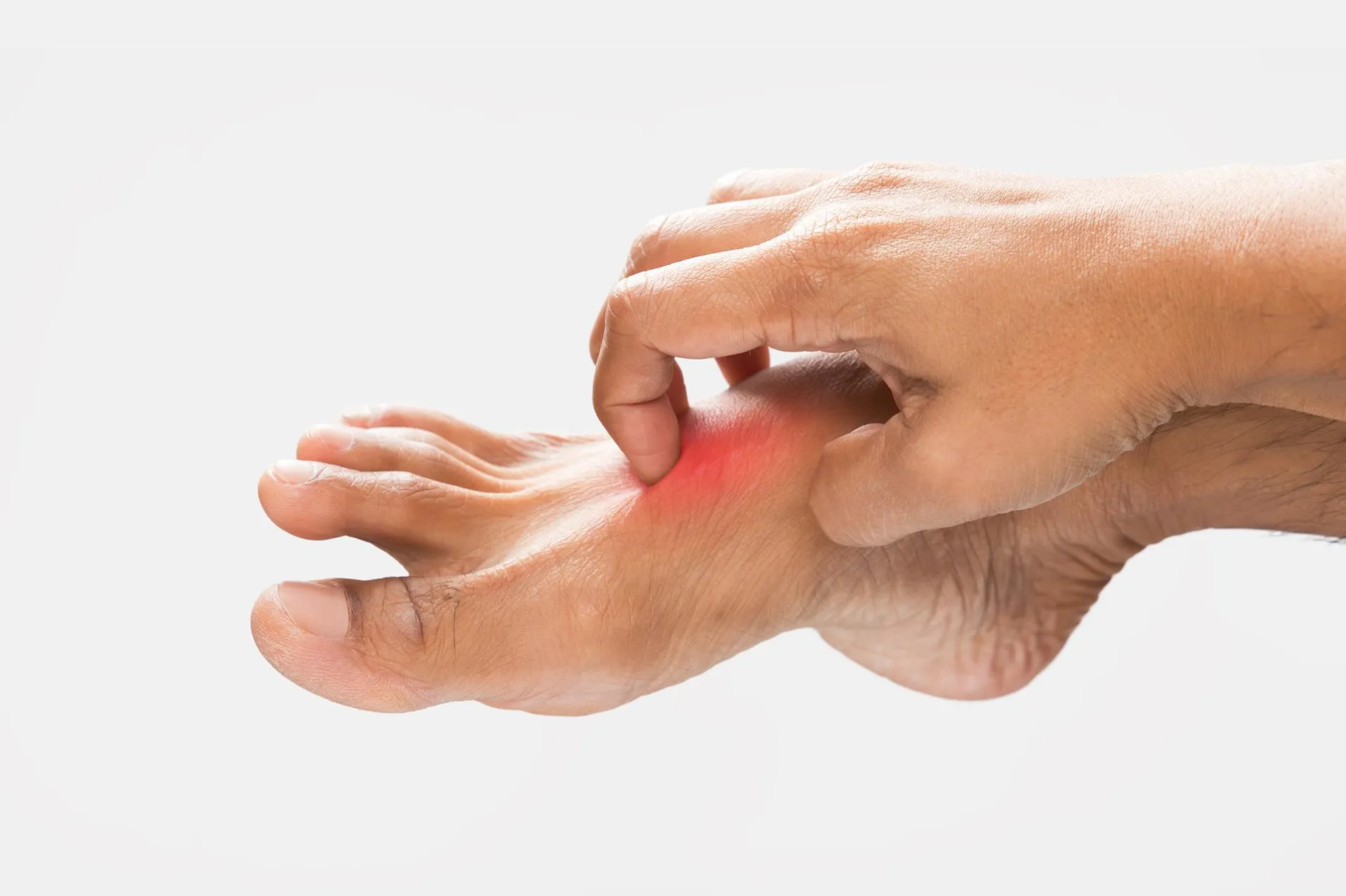 dolor en el empeine del pie al andar