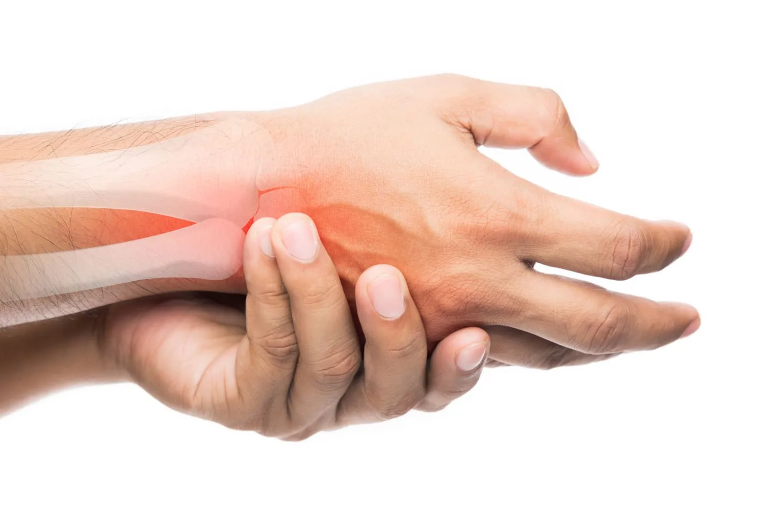 Dolor y Rigidez Post-Fractura