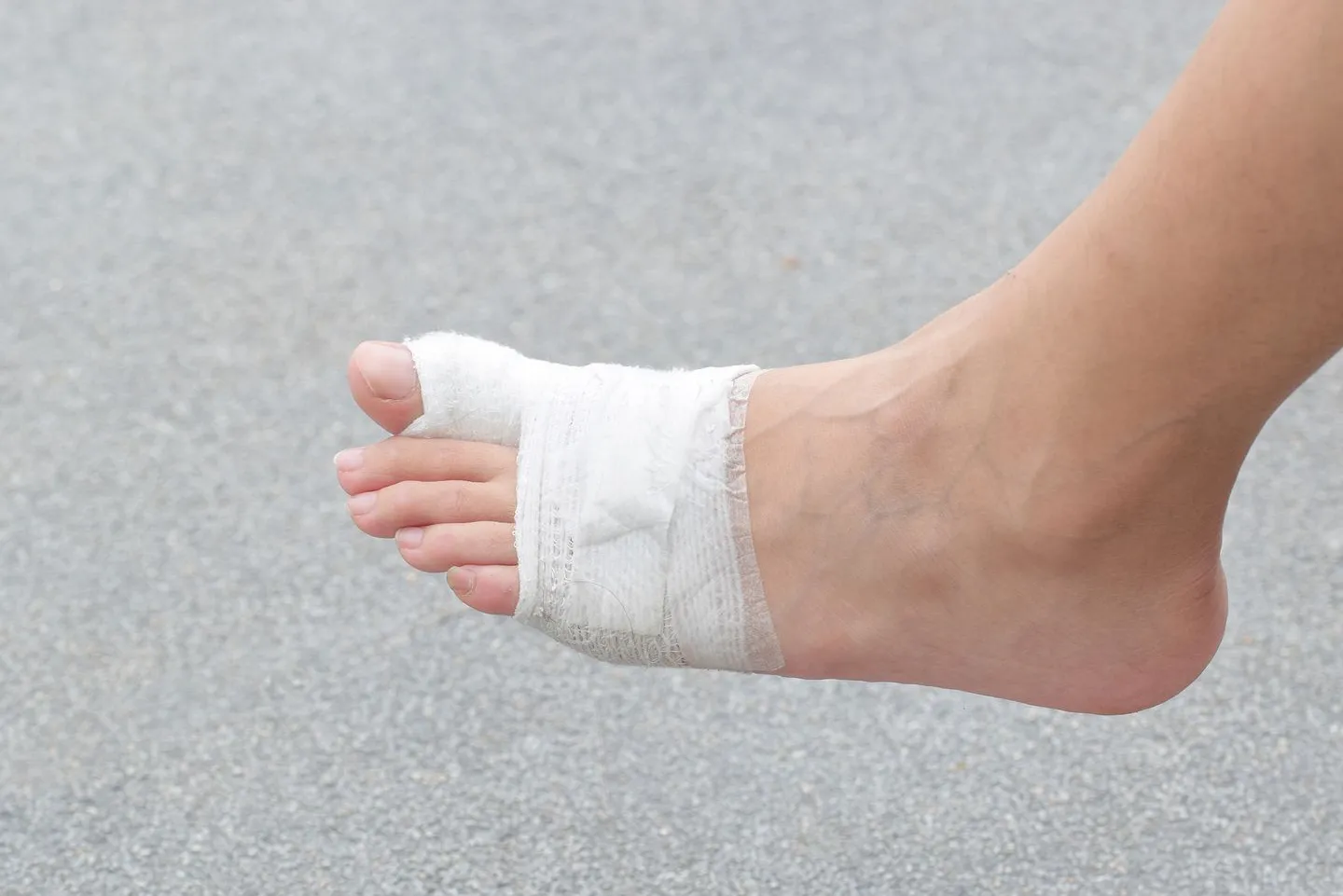 dolor en el segundo dedo del pie