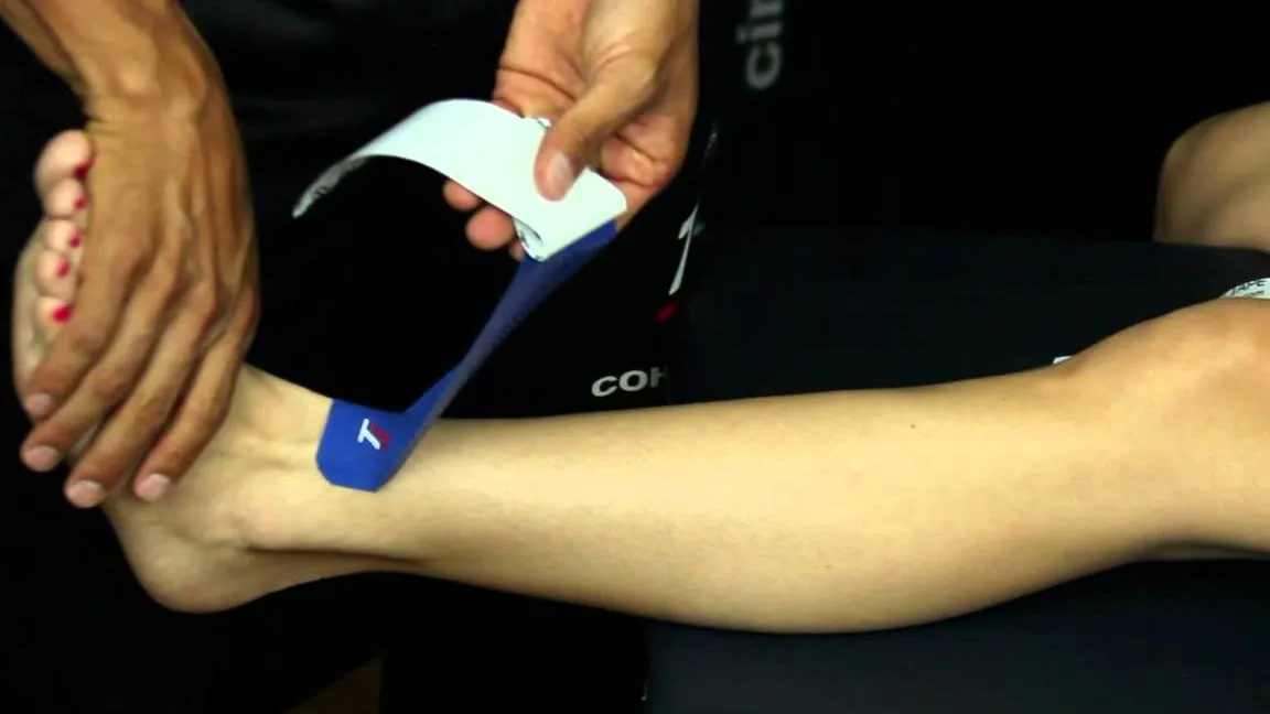 dolor tibial anterior al correr