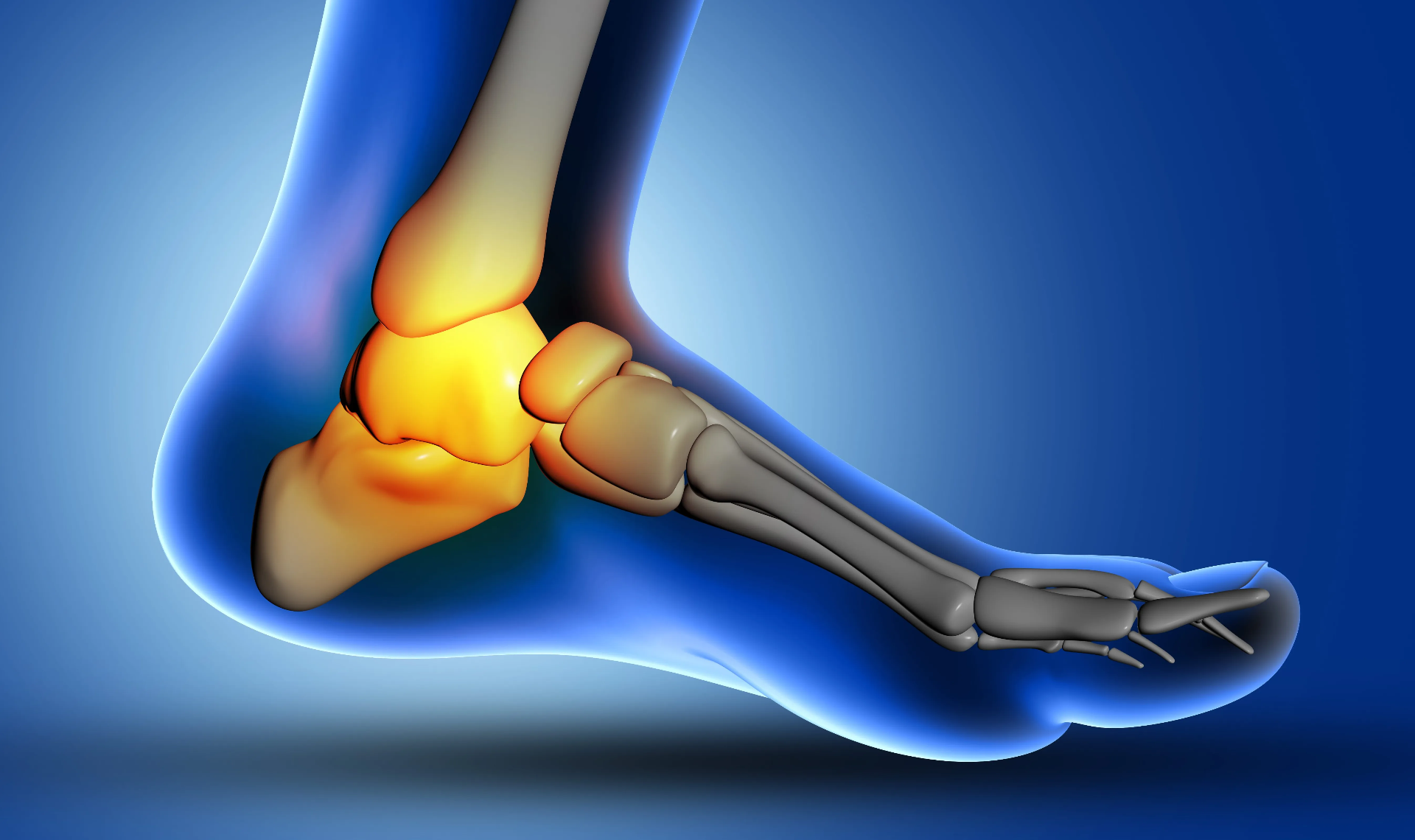 Esguince del Ligamento Deltoides (Tobillo)