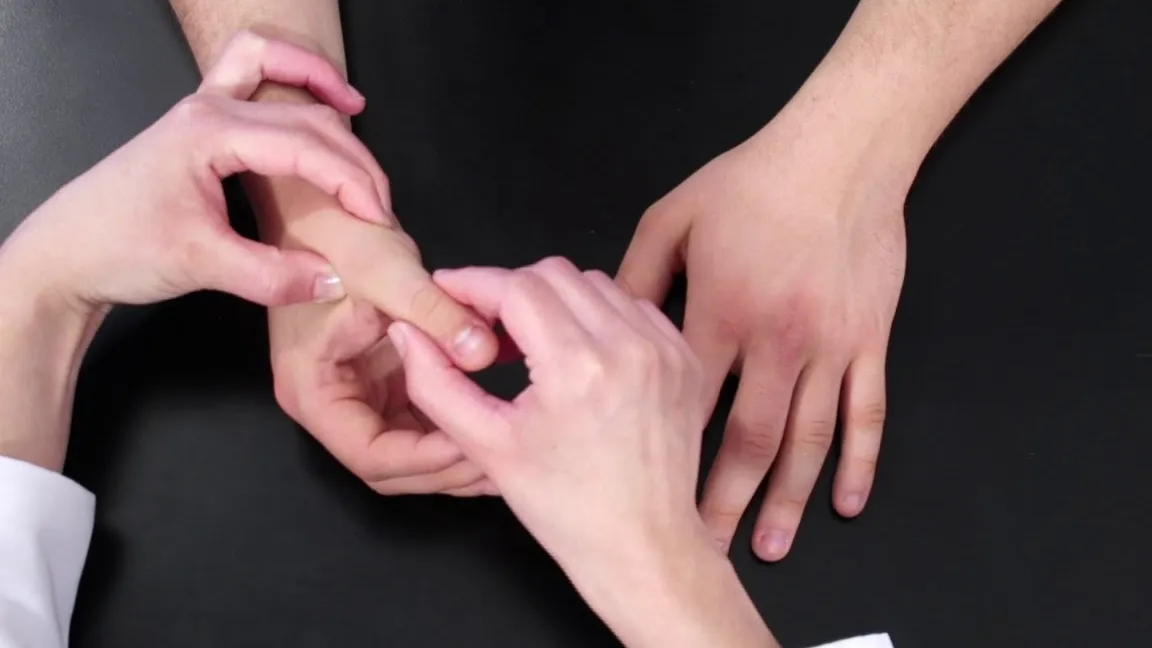 Esguince de Ligamentos en la Mano