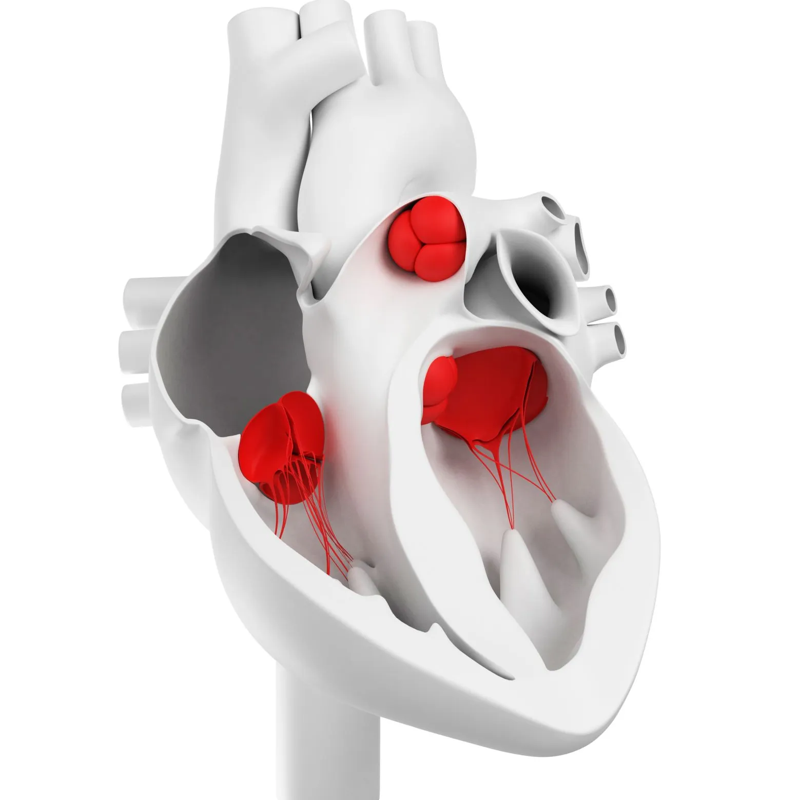 Estenosis de la Válvula Mitral (Corazón)