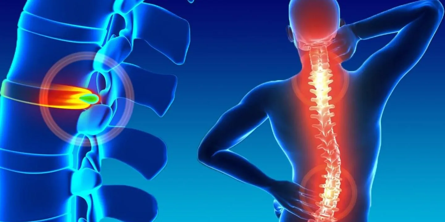 Fisioterapia Espinal