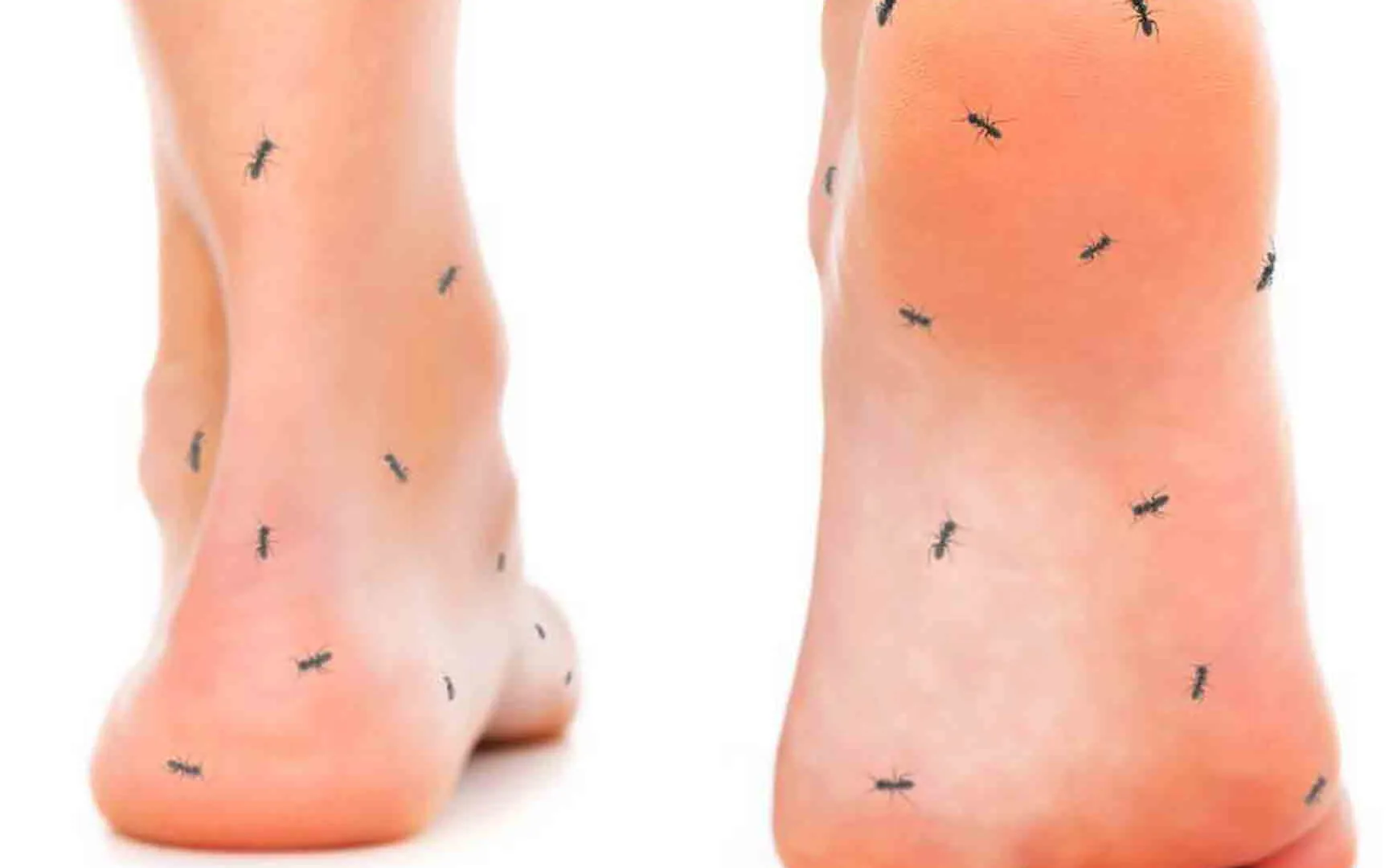 hormigueo en los pies