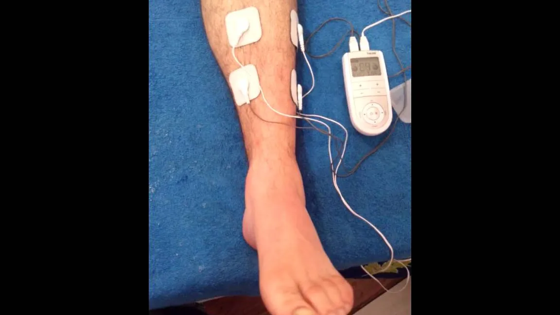 ioterapia para Tobillos y Pies