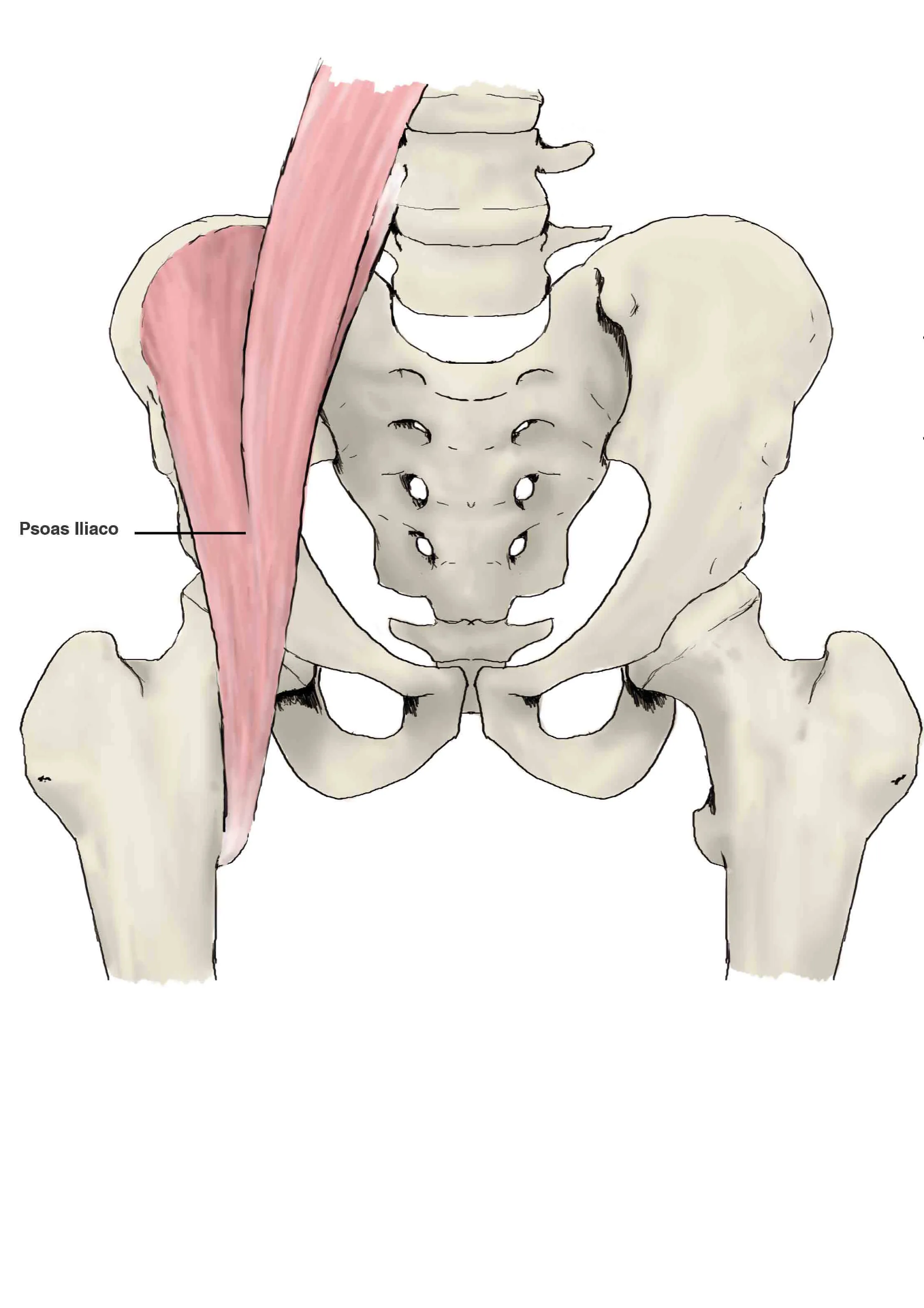 Lesión de Ligamento Pubofemoral (Cadera)