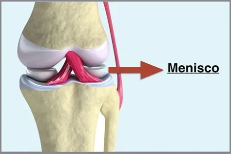 Lesiones de Meniscos
