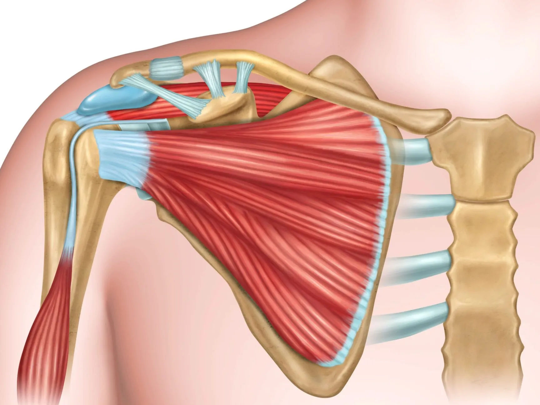 Tendinitis manguito rotador