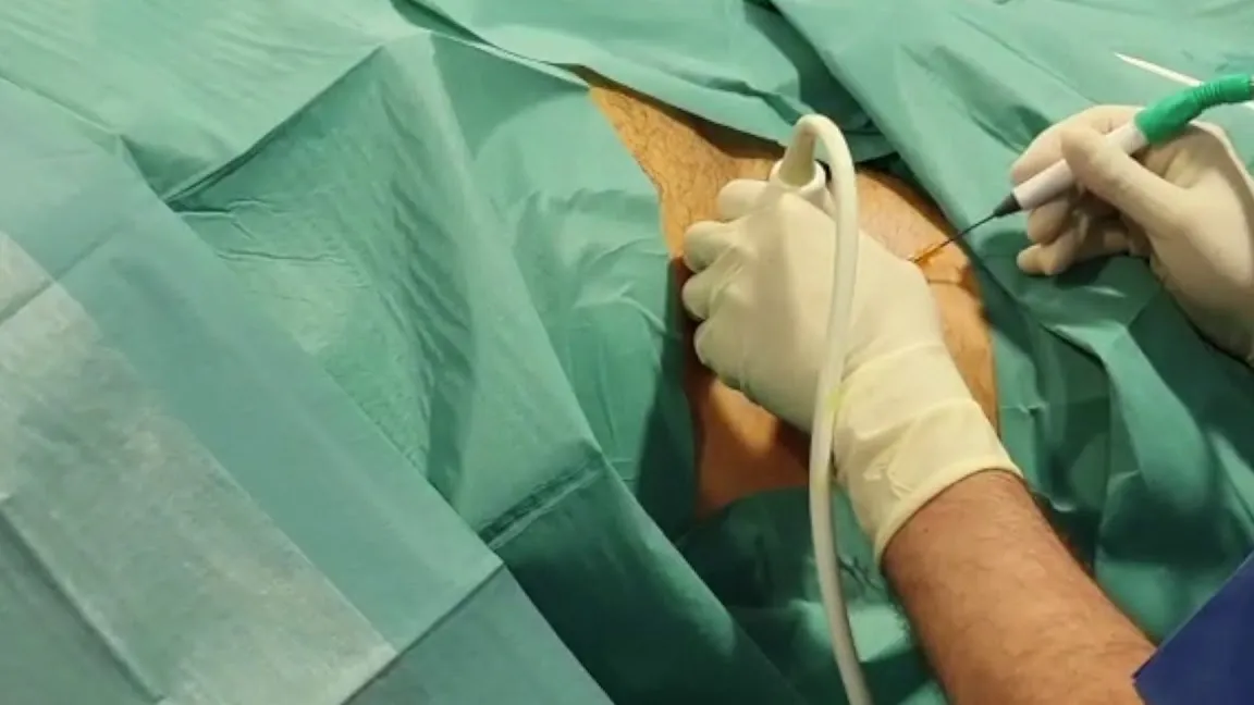Mialgia con Parestesia