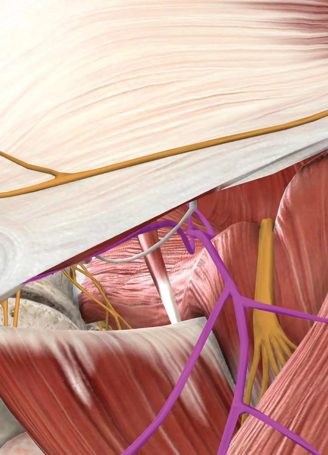 Neuralgia del Genitofemoral