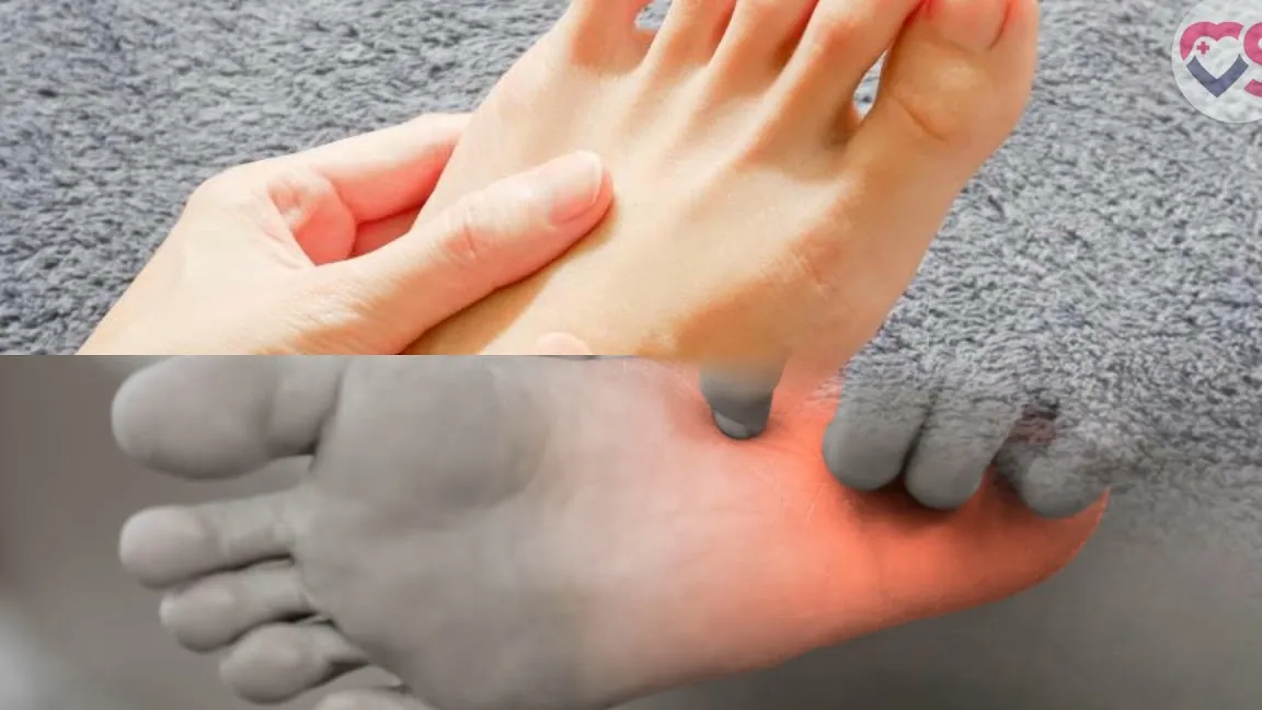 Pérdida de sensibilidad o neuropatía