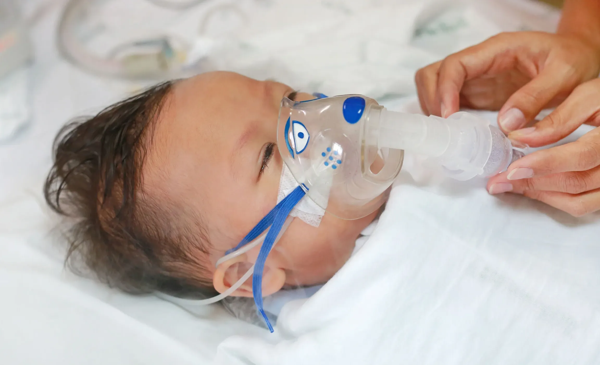 Problemas Respiratorios en Bebés