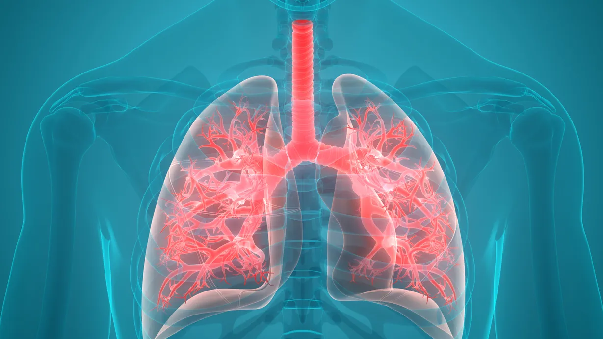 Reducción de la Capacidad Pulmonar