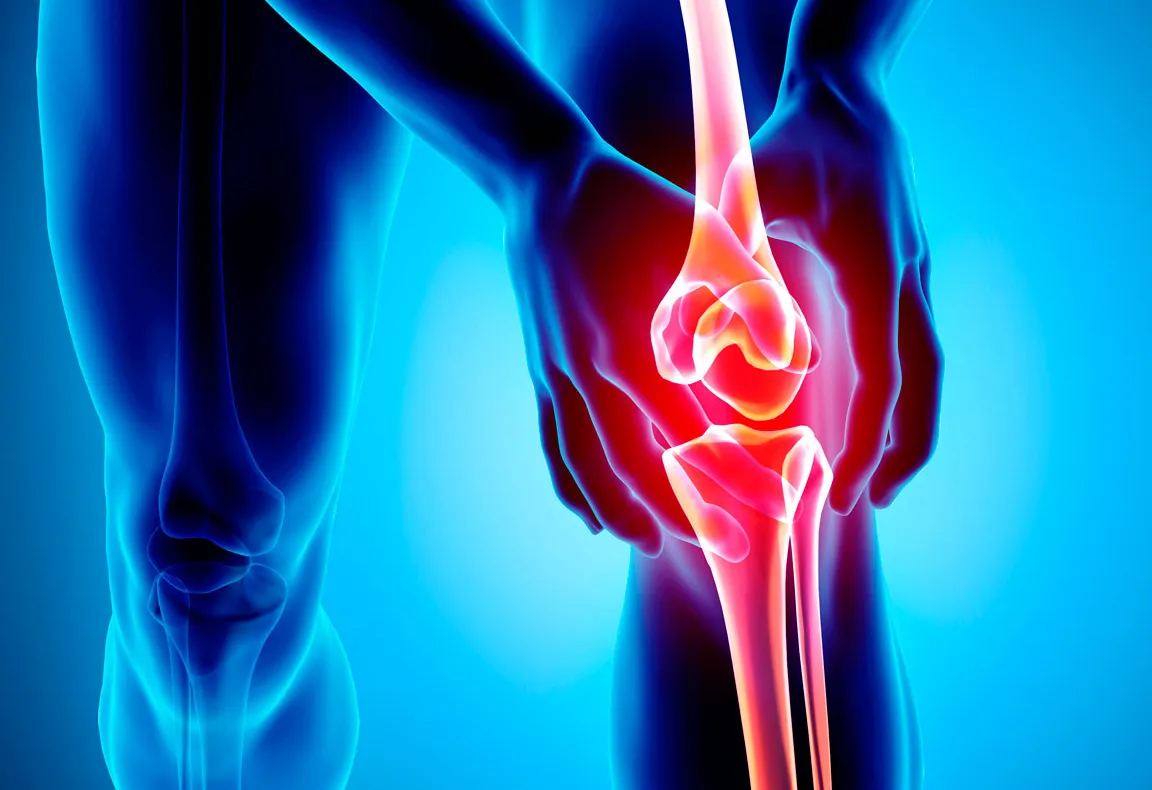 Tendinitis Anserina (Rodilla)