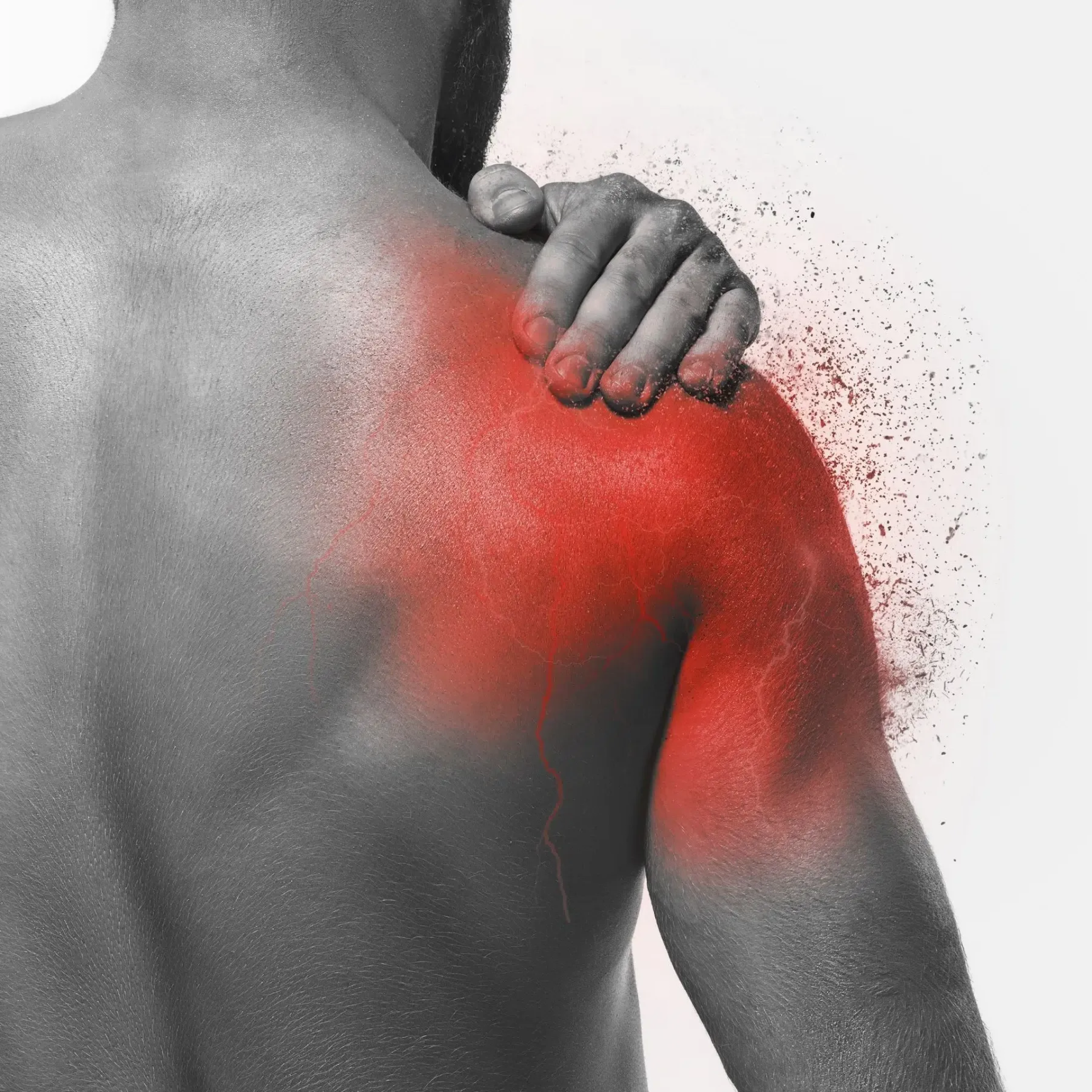 Tendinitis Bicipital (Hombro)
