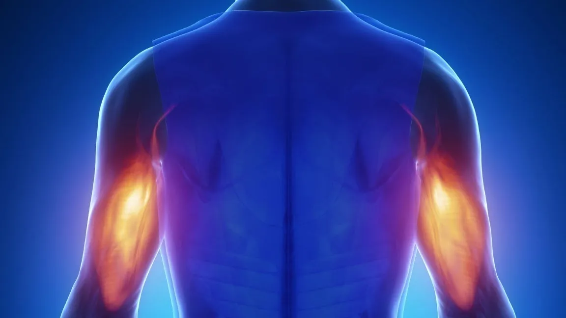 Tendinitis del Tríceps (Brazo)