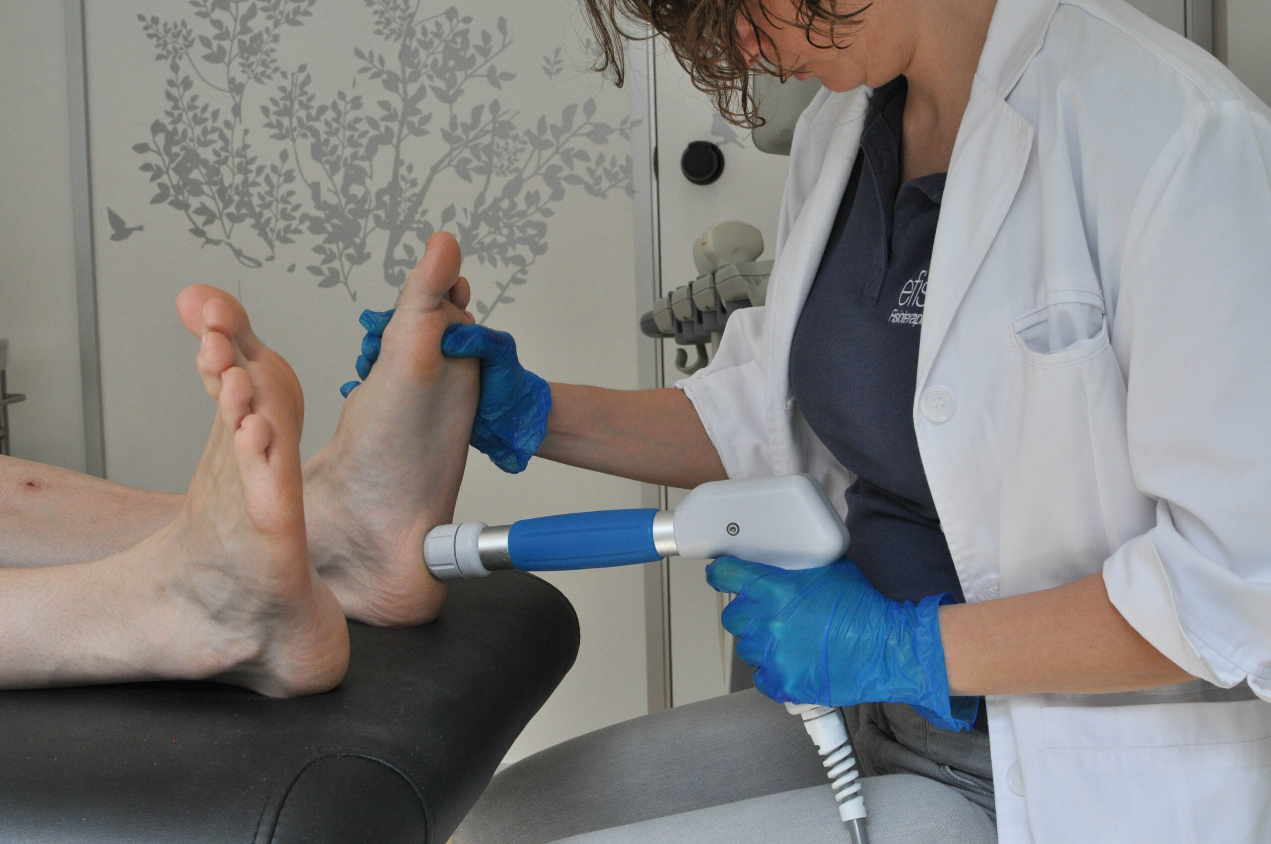 Ondas de choque para la fascitis plantar