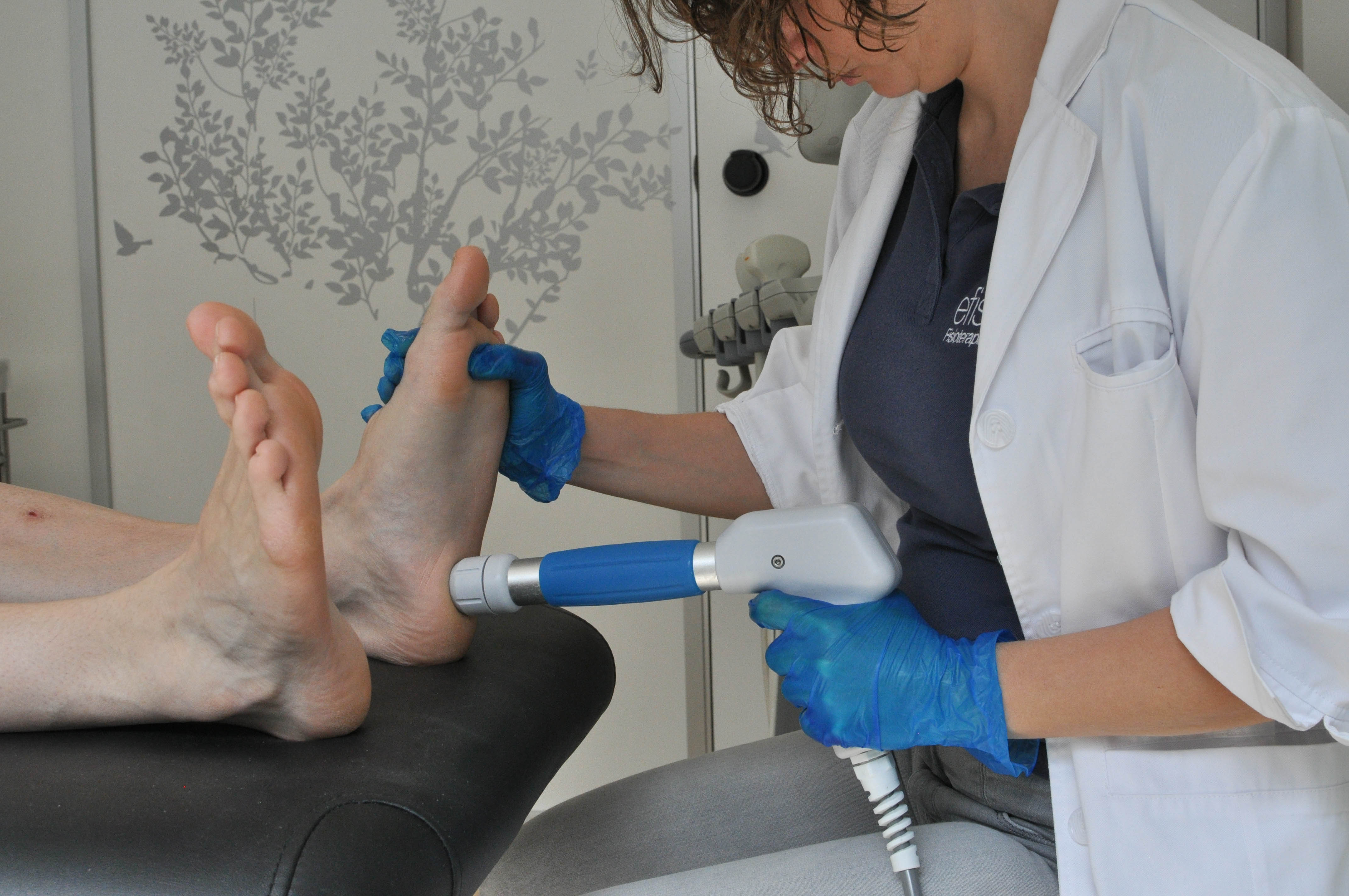 Ondas de choque para la fascitis plantar
