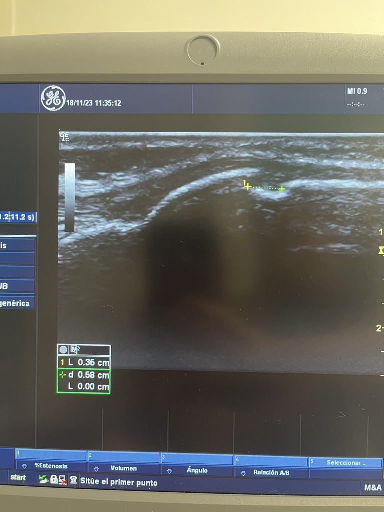 5D71468B 2A1C 425A 8BA6 E517CA37BDA4 1 105 c