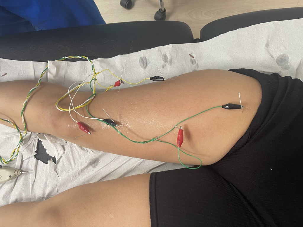 7EDE86EE 2CAC 4B0A 9D64 A7D93437651A 1 105 c