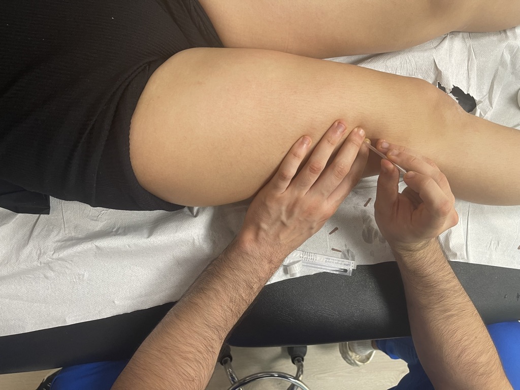 Soluciones Efectivas para el Dolor de Rodilla al Estirar: Guía de Fisioterapia 75 CD3C6A8E 5949 46E6 BDF1 8C07FE2FE32A 1 105 c