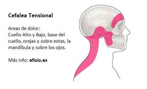 El Estrés, la Cefalea y tu Cuello: Un Círculo Vicioso