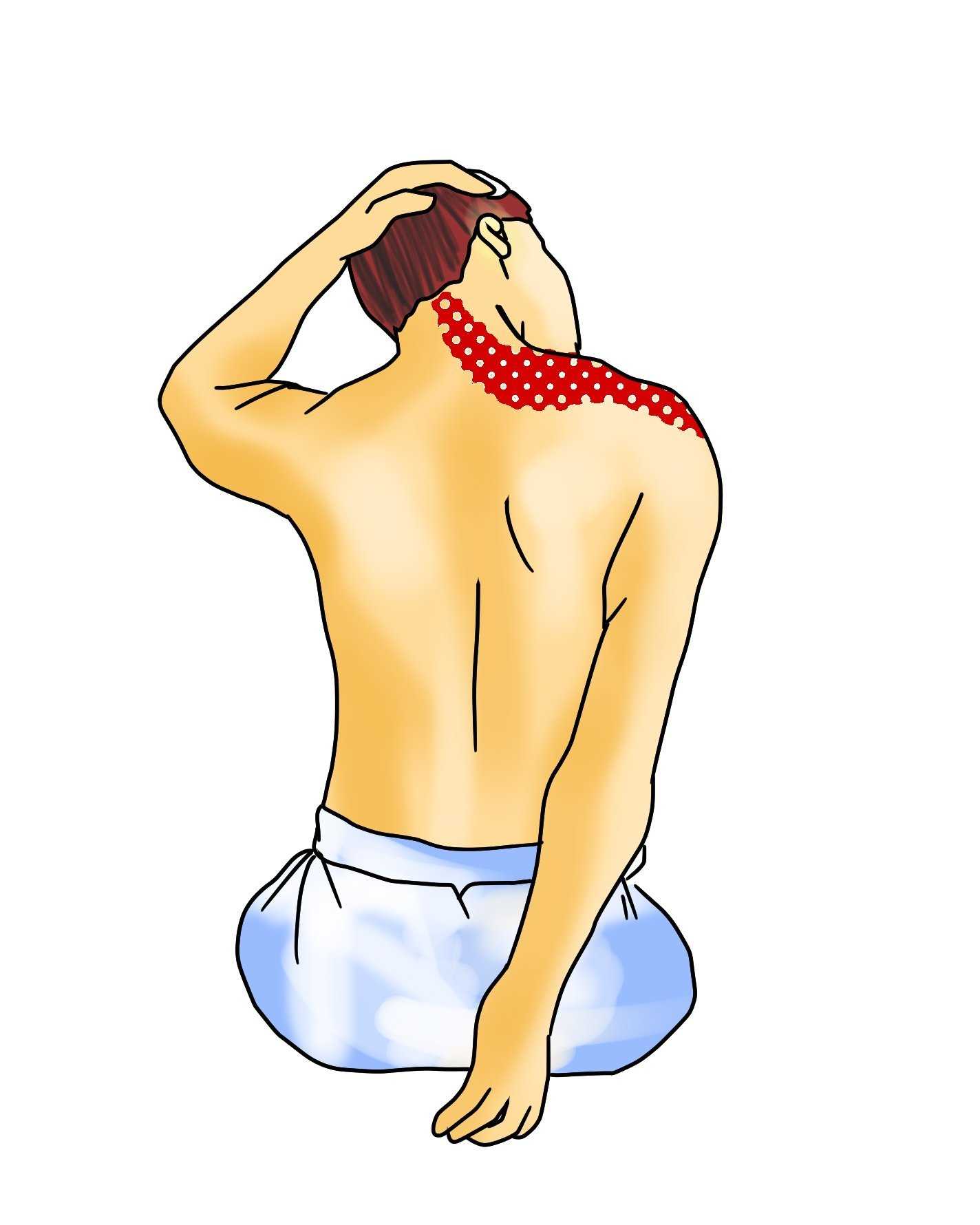Síndrome Cervicobraquial en Odontólogas