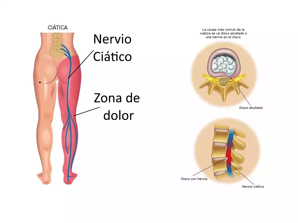 Rodilla en 'Pausa': ¿Reposo Absoluto o Movimiento Inteligente?