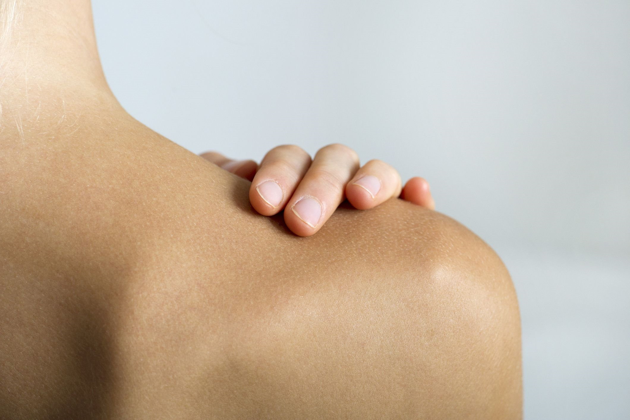 Esguince acromioclavicular: Tratamiento, Rehabilitación y ejercicios