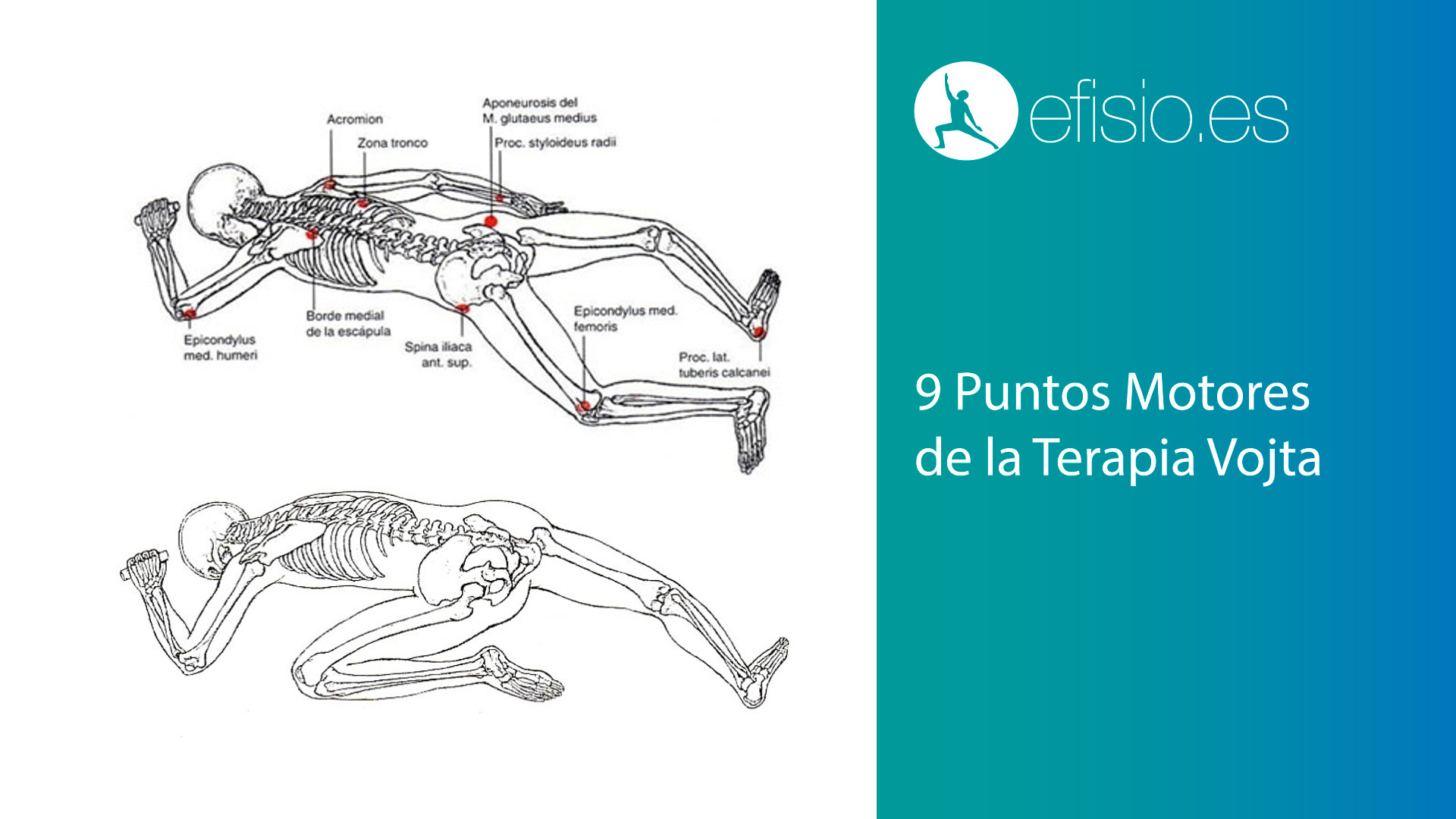 9 puntos de vojta puntos motores vojta madrid getafe