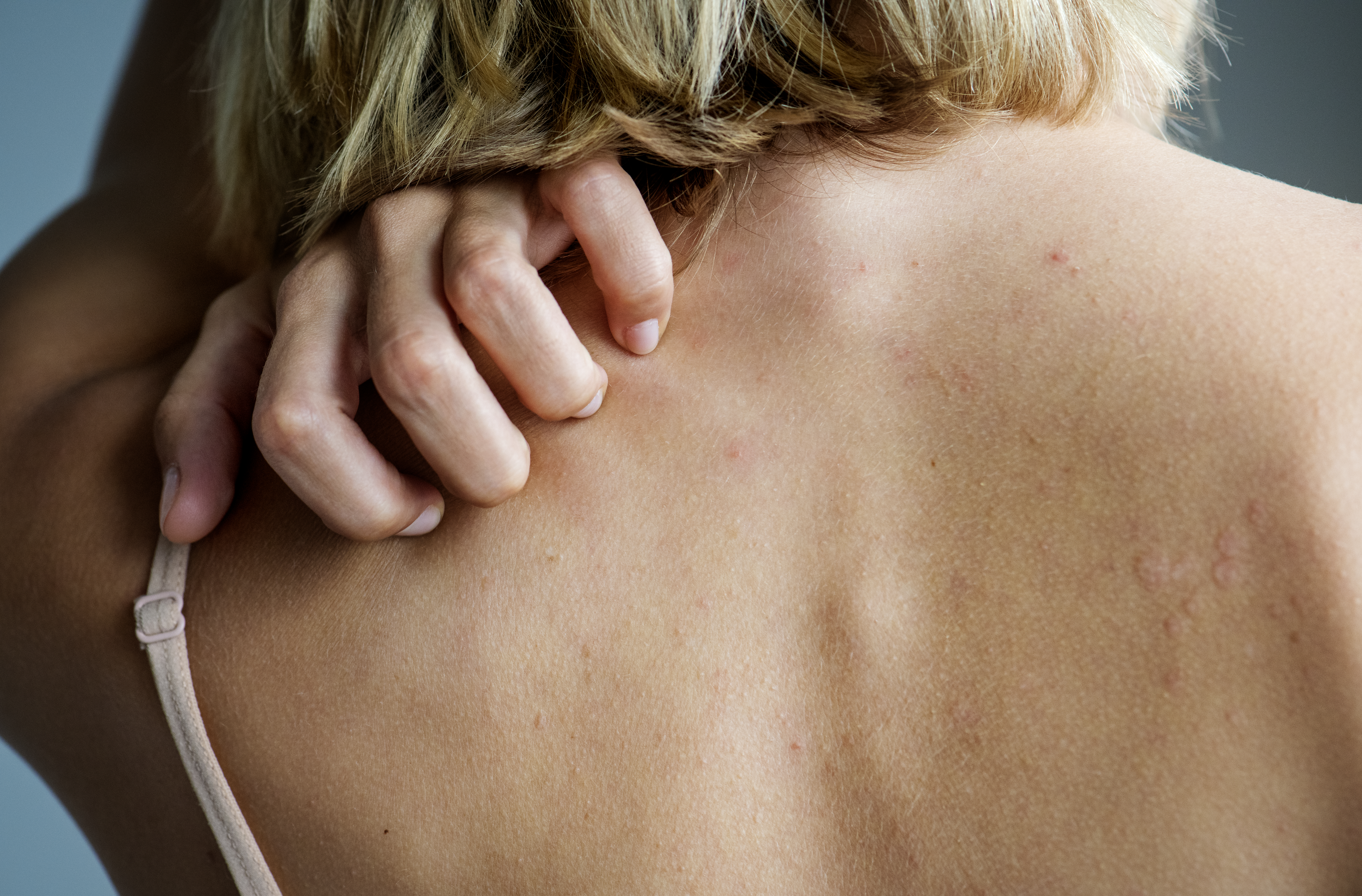 Dolor en la Parte Trasera de la Cabeza: ¿Qué es y Cómo la Fisioterapia Puede Ayudarte?