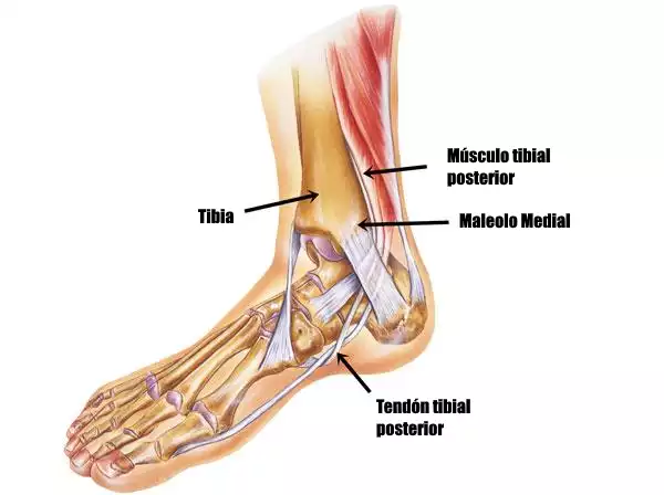Periostitis tibial: El desafío del militar... ¿y el tuyo?